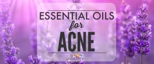 Essential Oils for Acne Natural Treatment