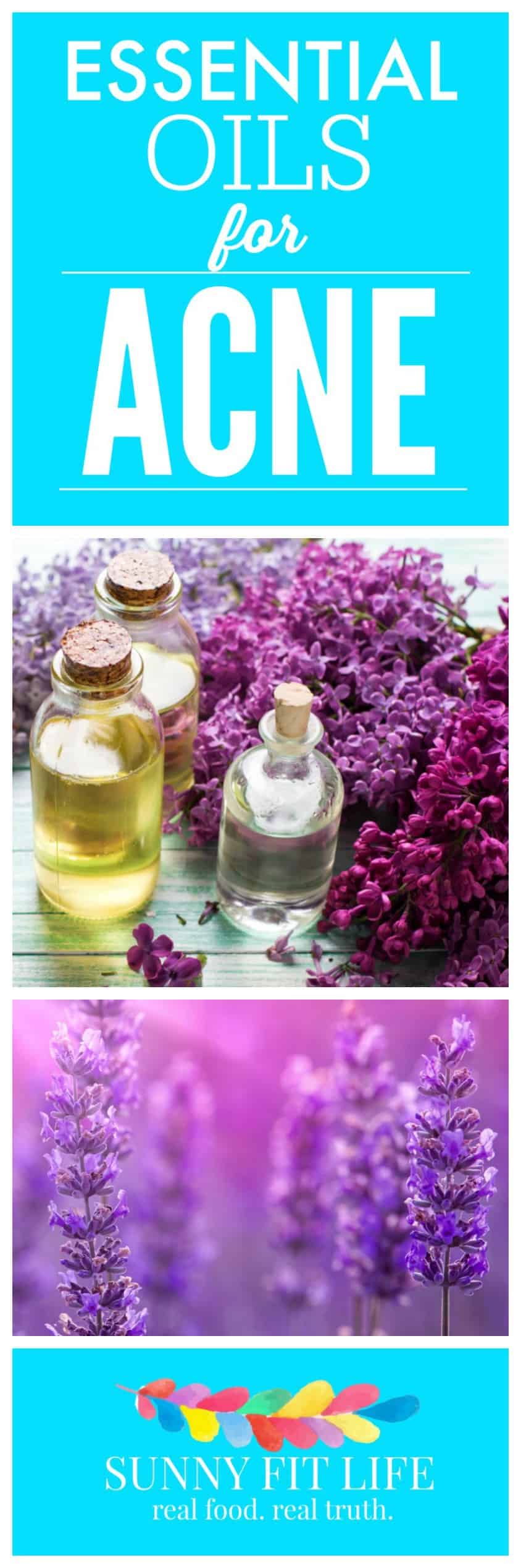 Essential Oils for Acne Natural Treatment